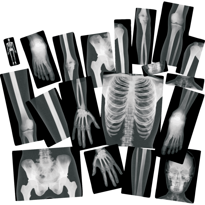 Roylco True to Life Human X-Rays 18/pkg